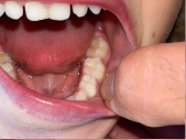 Taking a photo of childs teeth and mouth
