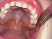 Taking a photo of childs teeth and mouth