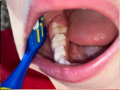 Taking a photo of childs teeth and mouth