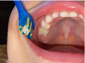 Taking a photo of childs teeth and mouth